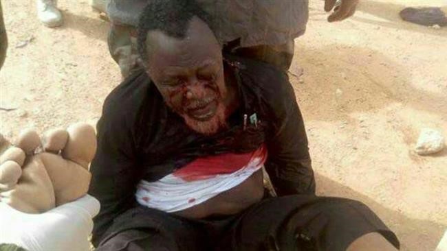 The Nigerian Army Confirms a brutal arrest of this Shia Leader, Sheikh Zakzaky.