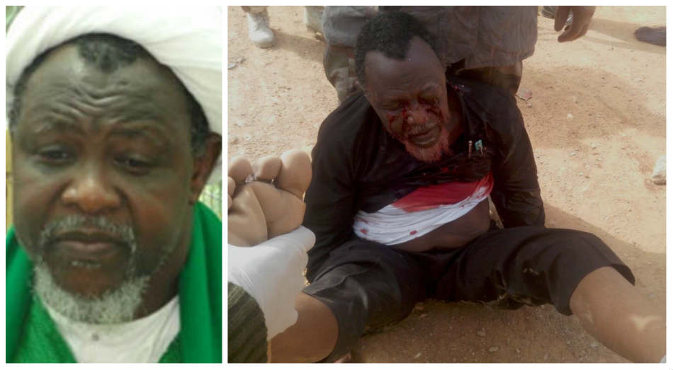 Photo of Injured Shiite Leader-Sheikh Zakzaky After Arrest By Soldiers