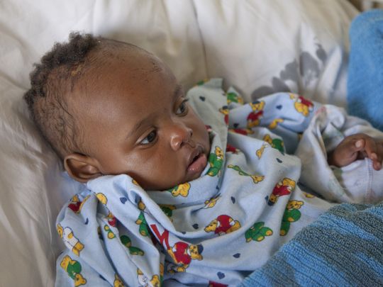 Dealeryn Saisi Wasike, the nearly 6-month-old girl who was rescued early Tuesday from the rubble of a building that collapsed in Nairobi, Kenya. (Photo: Sayyid Abdul Azim, AP)