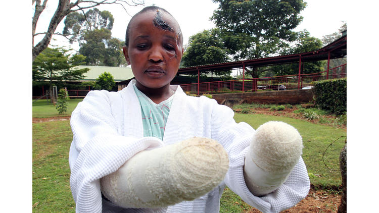 Jackline Mwende, 27, at Presbyterian Church of East Africa Kikuyu Hospital near Nairobi. (Reuben Kyama / For The Times)