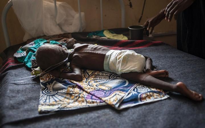 A young child suffering from severe malnutrition lies on a bed in the ICU ward at the In-Patient Therapeutic Feeding Centre in Maiduguri, Borno State Credit: STEFAN HEUNIS/AFP 